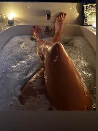 OnlyFans cuenta vitiligovada header 2