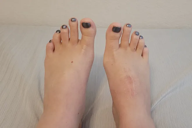 OnlyFans cuenta theleelatoes header 2