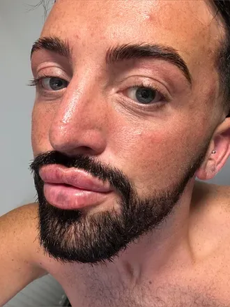 OnlyFans cuenta lilbattyboi avatar 1