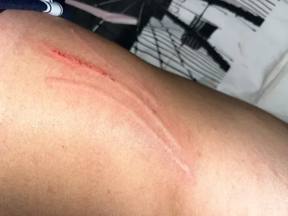 OnlyFans account  nailscratching header 2