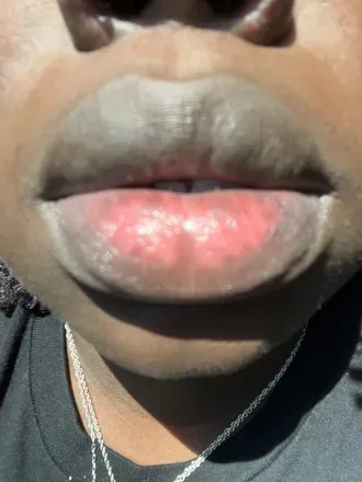 OnlyFans cuenta honeydriplip avatar 1