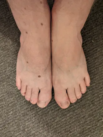 OnlyFans account  hairyhobbittoes avatar 1