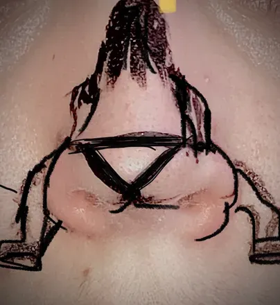 OnlyFans cuenta onlynose avatar 1