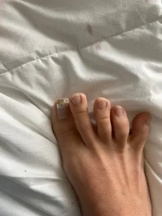 OnlyFans cuenta ugly_feet_dirty_street avatar 1