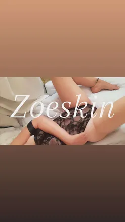 OnlyFans cuenta zoeskin header 2