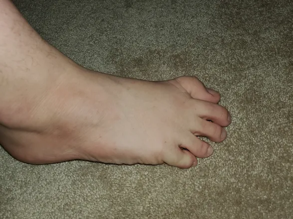 OnlyFans cuenta ictoesandfeet header 2