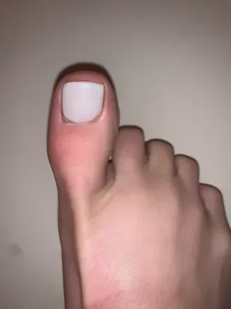 OnlyFans cuenta theofficialtoehoe avatar 1