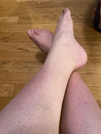 OnlyFans cuenta diabeticfeet avatar 1
