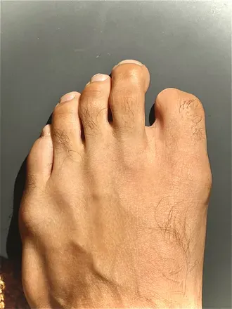 OnlyFans cuenta lilnugfoot avatar 1