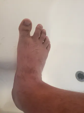 OnlyFans cuenta hopfeet header 2