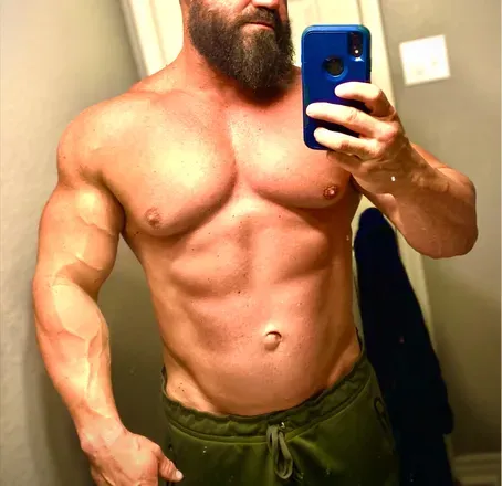 OnlyFans cuenta radekstrose avatar 1