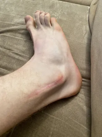 OnlyFans cuenta feetwithscares header 2