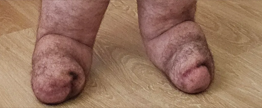 OnlyFans cuenta amputeeboy24 header 2