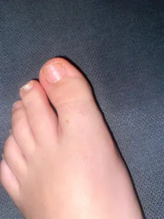 OnlyFans cuenta toedazie avatar 1