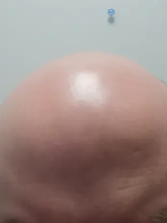 OnlyFans cuenta embracethebald avatar 1