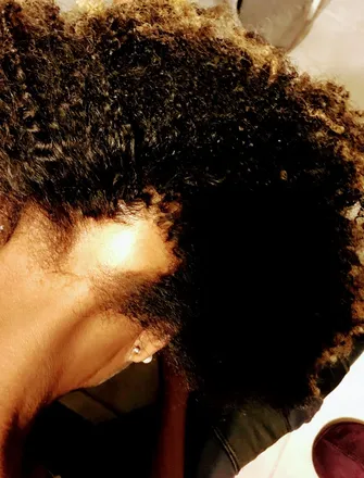 OnlyFans cuenta astutewithalopecia header 2