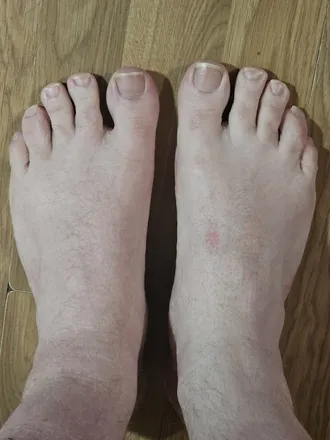 OnlyFans cuenta gingeyytoes header 2