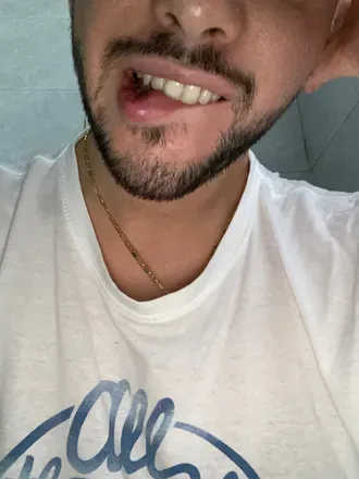 OnlyFans cuenta ale009911 header 1