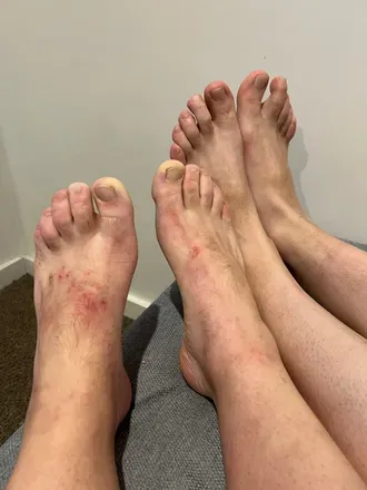 OnlyFans cuenta aussiefeetcouple69 avatar 1
