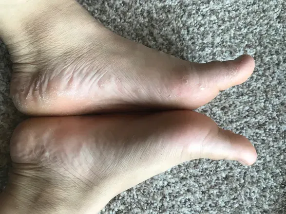OnlyFans cuenta scalyfeet header 1