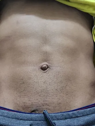 OnlyFans cuenta thebaldheadassain avatar 1
