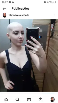 OnlyFans cuenta baldhot avatar 1