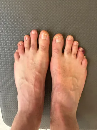 OnlyFans cuenta myuglyfeetaus header 2