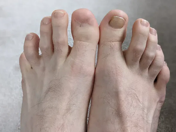 OnlyFans cuenta toenailguy avatar 1