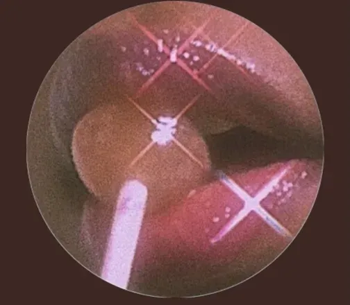 OnlyFans cuenta lexchanell avatar 1