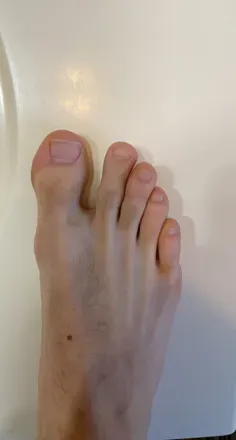OnlyFans account  sirhairyfeet avatar 1