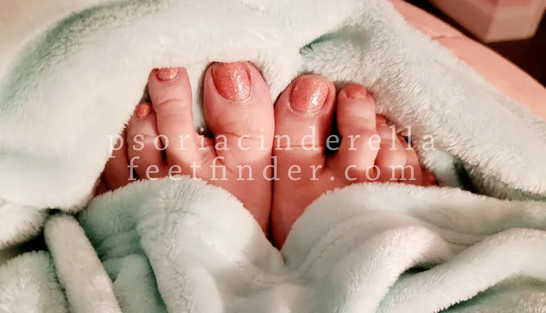 OnlyFans cuenta psoriacinderella header 2