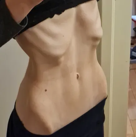 OnlyFans cuenta skin_and_bone avatar 1