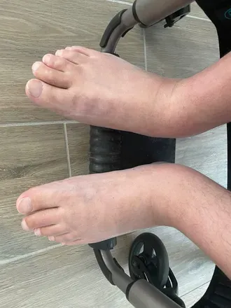 OnlyFans cuenta parafeet4life avatar 1