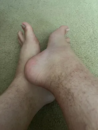 OnlyFans cuenta wide-feet avatar 1