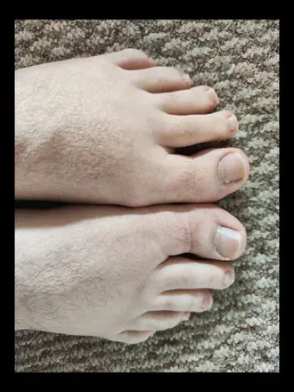 OnlyFans cuenta toe-talfeet avatar 1