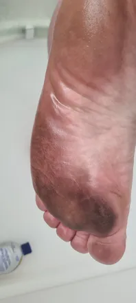 OnlyFans cuenta philfeet header 2