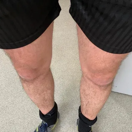 OnlyFans cuenta onlylegs88 avatar 1