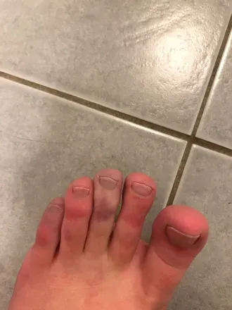 OnlyFans cuenta raynaudsfoot avatar 1