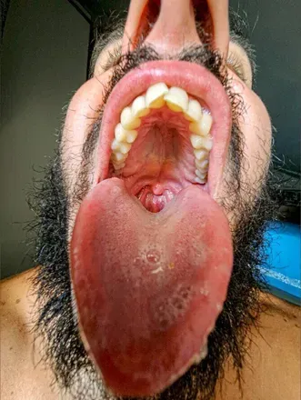 OnlyFans cuenta alexandervenom avatar 1