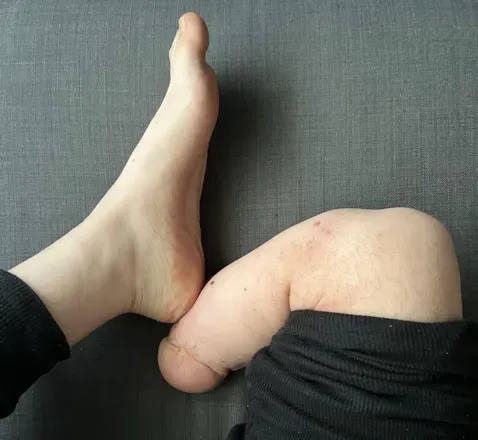 OnlyFans cuenta amputadohot avatar 1