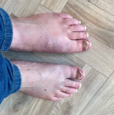 OnlyFans cuenta realusedfeet avatar 1