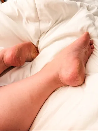 OnlyFans cuenta tillieshytoes header 2