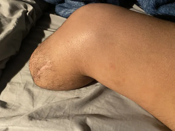 OnlyFans cuenta strongamputee header 2