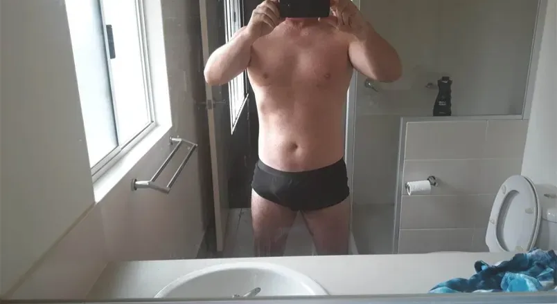 OnlyFans account  hairtransplantme avatar 1