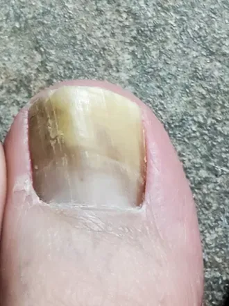 OnlyFans cuenta nastyfeet10 avatar 1