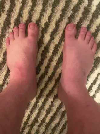 OnlyFans cuenta flattestfeet avatar 1
