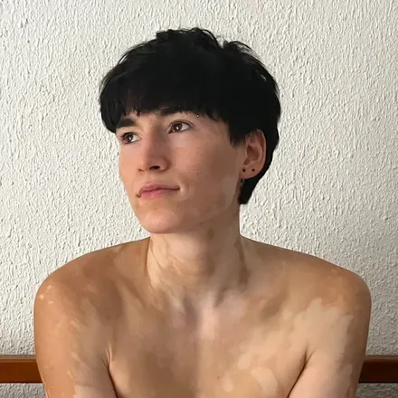 OnlyFans cuenta yourvitiligogirl avatar 1