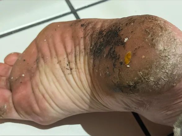 OnlyFans cuenta fckngdisgustingfeet header 2