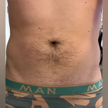 OnlyFans cuenta slickstarrr header 2