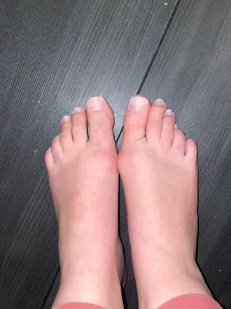 OnlyFans account  tootsiesfootsies98 header 2